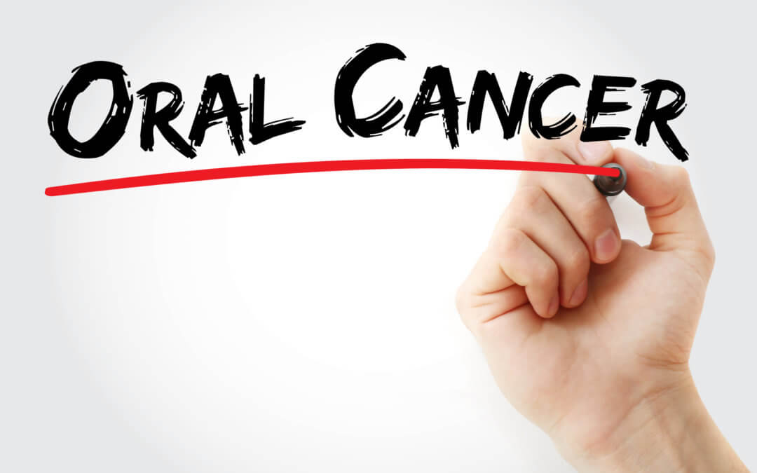 Early Warning Signs of Oral Cancer: What to Watch For